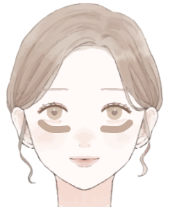 シミ・肝斑